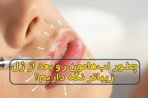 چطور لبهامون رو بعد از ژل زیباتر نگه داریم؟