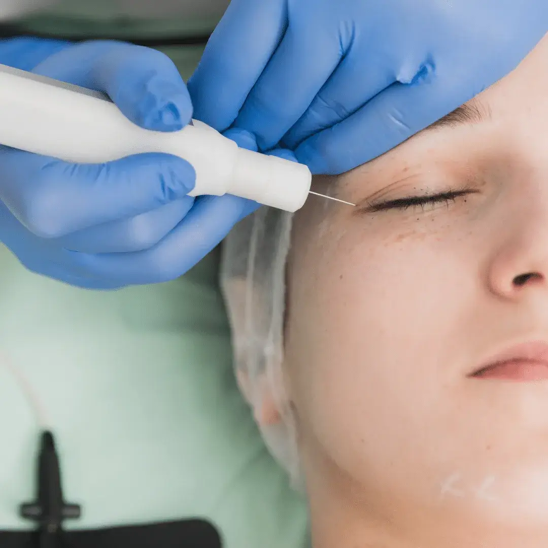 پلاسما و پلکسر